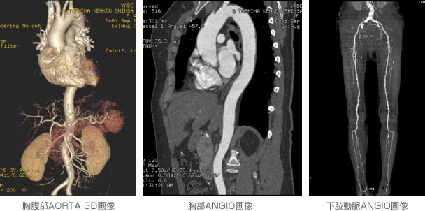 胸腹部AORTA 3D画像／胸部ANGIO画像／下肢動脈ANGIO画像