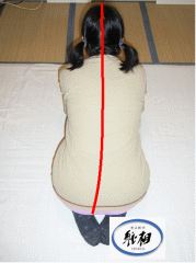 体のゆがみが原因で腰痛、肩こりがあった例